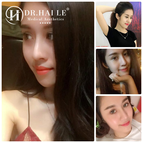 quot;Tháng vàng tri ân” tặng tới 50% phí làm đẹp tại Dr.Hải Lê - 2