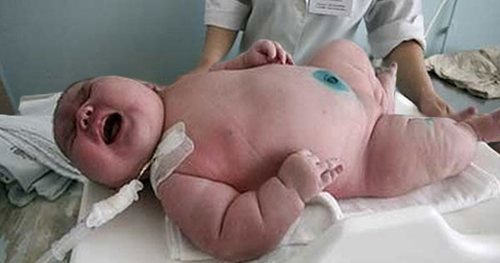 The truth about the 300kg mother who struggled to give birth to the heaviest child in the world - 2