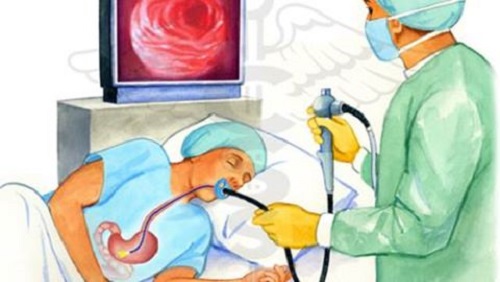 Cô gái bị 40 hạch ung thư trong dạ dày và lời cảnh báo mỗi khi đau bụng, ợ chua - 1