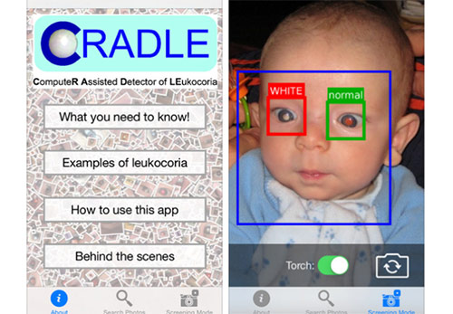 Xem ảnh sơ sinh của con bị ung thư mắt, bố quot;rùng mìnhquot; phát hiện điều kỳ lạ - 2