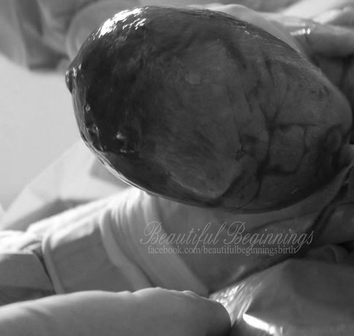 Ảnh hiếm về khoảnh khắc kỳ diệu khi sinh con ai cũng muốn một lần được xem - 7