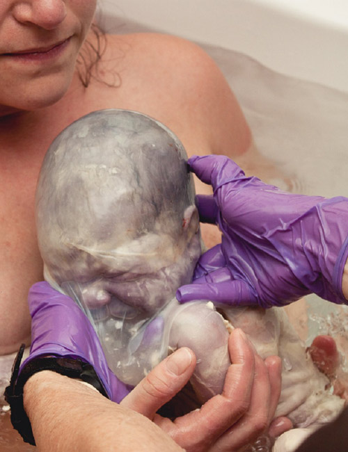 Ảnh hiếm về khoảnh khắc kỳ diệu khi sinh con ai cũng muốn một lần được xem - 9