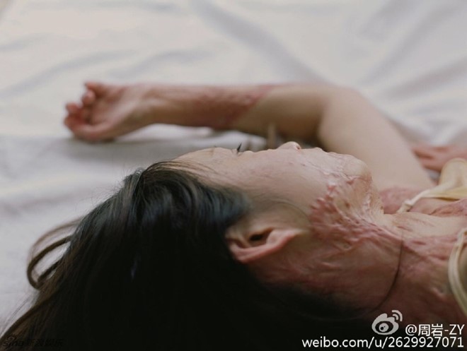 Sau 5 năm, người mẫu teen Trung Quốc từng bị thiêu sống vì tình lộ diện - 6