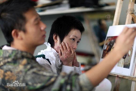 Sau 5 năm, người mẫu teen Trung Quốc từng bị thiêu sống vì tình lộ diện - 7