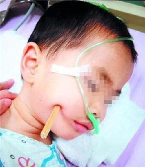 Đồ vật quen thuộc trong mâm cơm của các gia đình lại là “sát thủ” với trẻ nhỏ - 2