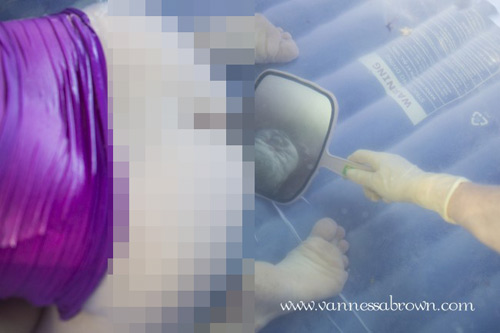 Ca đẻ thường giữa thiên nhiên quá lạ lẫm với mẹ Việt - 9