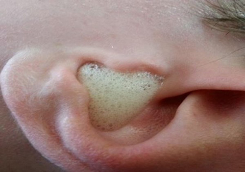 4 công dụng làm đẹp quot;thần thánhquot; ít người biết của cồn y tế - 5