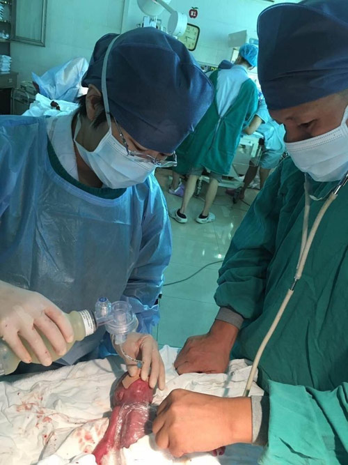 Cặp song sinh bé bằng bàn tay sống sót thần kỳ - 2