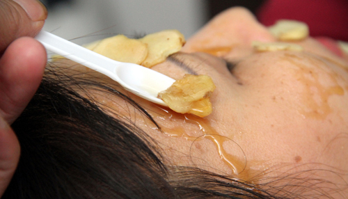 2 cách trị sẹo thâm trên da không hề tốn kém từ nhánh gừng - 5