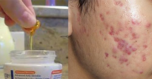 4 công dụng làm đẹp của Vitamin E nhất định bạn phải biết - 2