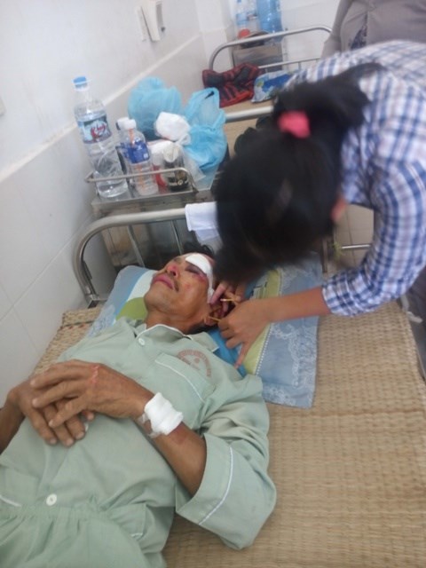 Người đi đường bị máy bay L39 gặp nạn lao trúng kể phút cận kề cái chết - 2