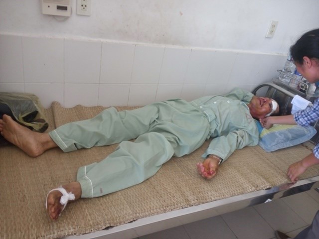 Người đi đường bị máy bay L39 gặp nạn lao trúng kể phút cận kề cái chết - 1