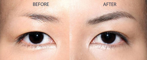 Phun xăm thẩm mỹ: Nghề làm thoải mái nhưng ‘hái’ ra tiền - 4