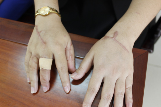 Chém hai mẹ con hàng xóm suýt chết vì ảo giác bị chửi - 2