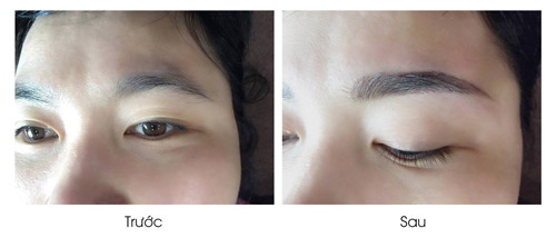 Làm đẹp không sưng, không đau, thư giãn như đi resort - 2