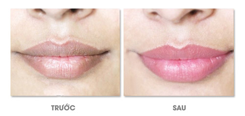 Làm đẹp không sưng, không đau, thư giãn như đi resort - 3