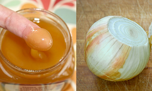 Sẹo lồi khó chữa đến mấy cũng “xẹp” ngay với hỗn hợp này - 3