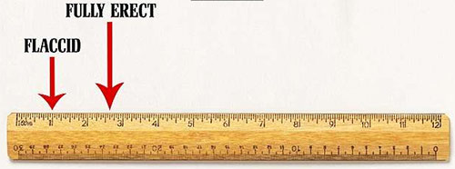 Chàng trai có quot;cậu béquot; 7cm chia sẻ cuộc đời bi thảm khi làm chuyện ấy - 2