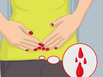 Mang thai ngoài tử cung - Rất nguy hiểm nhưng không hề hiếm gặp