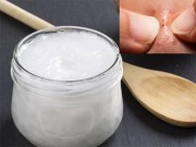 Làm đẹp - Những công dụng của dầu dừa sẽ khiến bạn muốn mua cả chai dùng dần