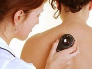 Sức khỏe - Cách phân biệt mụn nhọt thông thường và ung thư da