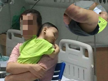Sự thật về người mẹ của bé trai 14 tháng tuổi bị hành hung, bỏ rơi tại bệnh viện