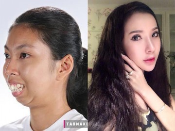Vỡ mộng vì quá khứ xấu khó tin của loạt nam - nữ thần Thái Lan trước phẫu thuật thẩm mỹ