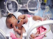 Làm mẹ - Tưởng con hiếu động phun nước bọt, mẹ ngã ngửa khi biết là do mắc bệnh