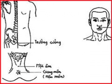 Chuyên gia hướng dẫn cách xử lý thượng mã phong khi quan hệ