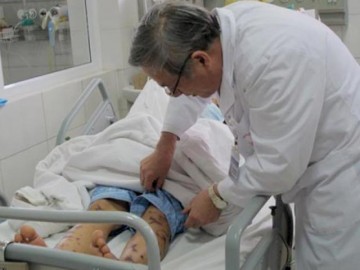 Hà Nội: Phát hiện ca mắc viêm não mô cầu đầu tiên trong năm nay