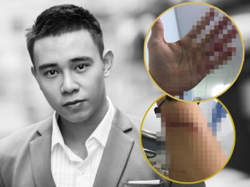 Sao Việt bàng hoàng trước thông tin ca sĩ Đông Hùng bị chém vì mẹ ruột nợ nần