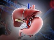 Sức khỏe - Nóng gan, chớ xem thường!