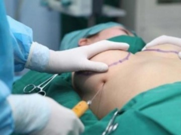 Bộ Y tế truy khẩn nguyên nhân vụ thai phụ tử vong sau khi nâng ngực