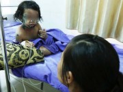 Tin tức - Mẹ chểnh mảng không vệ sinh cẩn thận, con gái 5 tuổi bong tróc da toàn thân