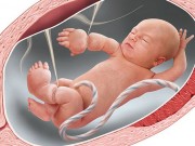 Bà bầu - Siêu âm thai, mẹ hoảng sợ khi bác sĩ nói bàn tay con bị dải sợi ối cắt đứt lìa