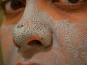 Làm đẹp - Cách trị mụn cám, mụn đầu đen với kem đánh răng siêu đơn giản