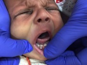 Tin tức - Em bé đầu tiên trên thế giới vừa lọt lòng mẹ đã có 7 chiếc răng