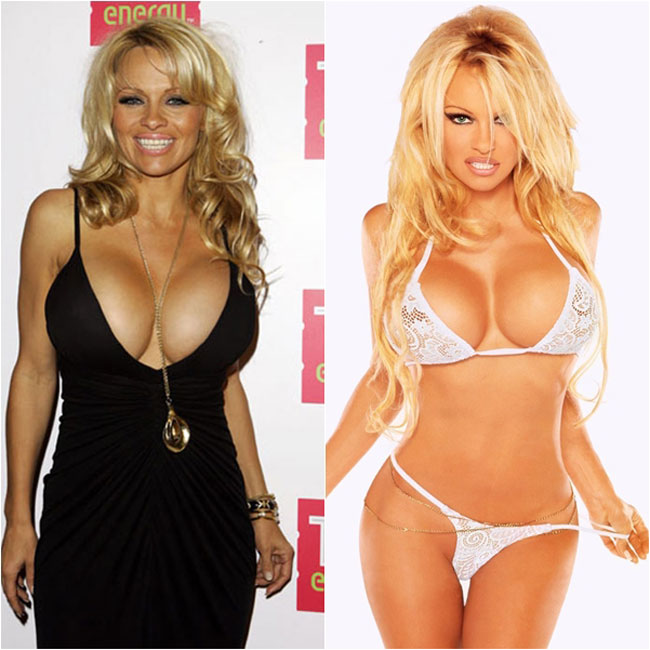 Được mệnh danh là “Quả bom sex”, Pamela Anderson đi tiên phong trong phong trào nâng cấp vòng 1 bằng phương pháp phẫu thuật.
