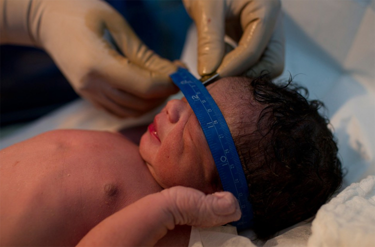 Sau sinh, em bé được các bác sĩ vệ sinh sạch sẽ và lấy các số đo cơ bản.

