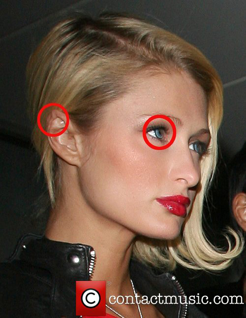 Paris Hilton: Quá nhiều điểm xấu trên cơ thể - 14