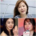 Làm đẹp - Chae Rim ‘thảm hại’ sau phẫu thuật thẩm mỹ
