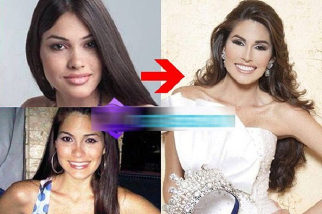 Những bức ảnh trước kia của Maria Gabriela Isler được công bố cho thấy ngày trước chiếc mũi của Hoa hậu khá gẫy, không được cao thẳng như hiện tại. Đó là lý do vì sao cô bị nghi ngờ đã phẫu thuật thẩm mỹ mũi. 





