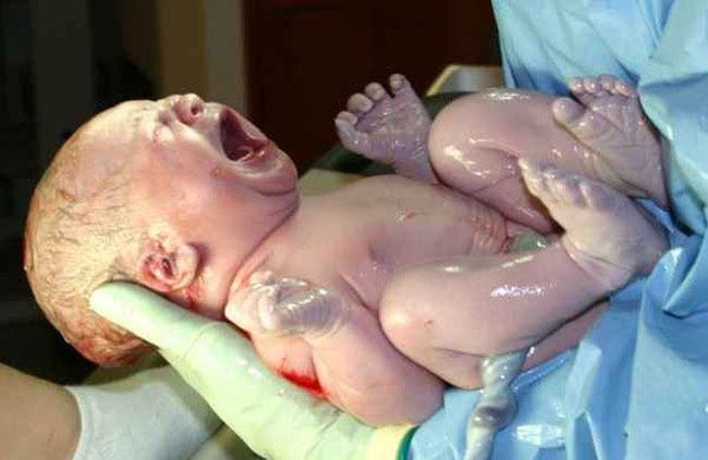 Các bác sĩ sẽ đưa bé đi thực hiện lần tắm rửa đầu tiên trong đời.
