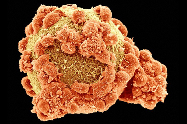 Hình ảnh chụp qua kính hiển vi quét màu giả của một tế bào trứng của con người (vàng) được bao quanh bởi các tế bào cumulus (màu cam). Tế bào cumulus giúp nuôi dưỡng tế bào trứng lớn lên khi nó phát triển trong nang buồng trứng.
