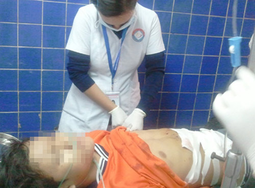 Quảng Nam: Nổ kíp mìn, một học sinh cụt cả hai bàn tay - 1
