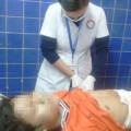 Tin tức - Quảng Nam: Nổ kíp mìn, một học sinh cụt cả hai bàn tay