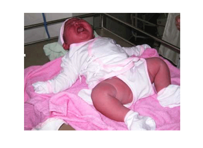 Tại Việt Nam đã ghi nhận có bé sơ sinh nặng đến 6kg ở Bình Thuận. Bé chào đời ngày 25-11 vừa qua tại Bệnh viện Đa khoa An Phước bằng phương pháp đẻ mổ.

BÀI LIÊN QUAN:

“Yêu” sau sinh, cẩn thận hậu sản

Quá đẹp thước ảnh sinh con dưới nước

Sang Trung Quốc xem các mẹ đi đẻ

“Soi tận mắt' quá trình thụ thai

“Chết cười” ngắm thai nhi tạo dáng

Ngắm thai nhi lớn lên trong bụng mẹ (P.2)

Thai nhi nam có thể “cương cứng” 
