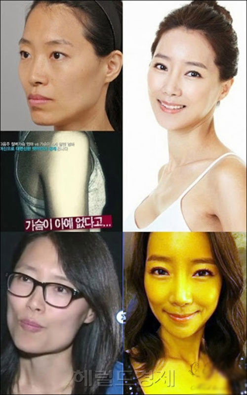 Mẹ 3 con phẫu thuật để giống tình địch - 5