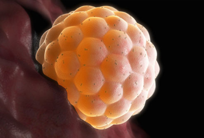 Cấy vào thành tử cung

Sau khi di chuyển đến thành tử cung, trứng đã thụ tinh bám vào niêm mạc, nội mạc tử cung. Quá trình này được gọi là cấy vào thành tử cung. Các tế bào tiếp tục phân chia.

BÀI LIÊN QUAN:

10 dấu hiệu báo mẹ sắp rụng trứng

Cực lãng mạn tinh trùng 'tỏ tình' trứng

Đừng vô tình 'giết chết' tinh trùng!

8 thời điểm “cấm” thụ thai

Chiêu thử thai chính xác 100%

Sai lầm ‘chết người’ khi mang thai

10 dấu hiệu cực nguy hiểm 3 tháng đầu
