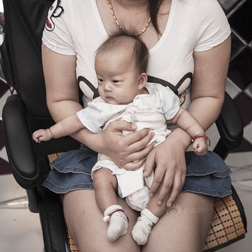 Ảnh chân thực về chiếc bụng nhăn nhúm sau đẻ mổ - 10